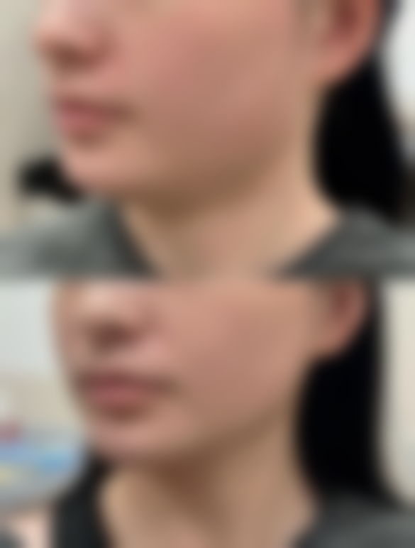 【海南伊佳整形医院是正规的吗?】