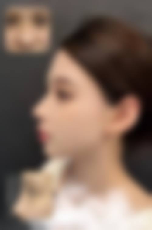 【张哲医生怎么预约挂号？】
