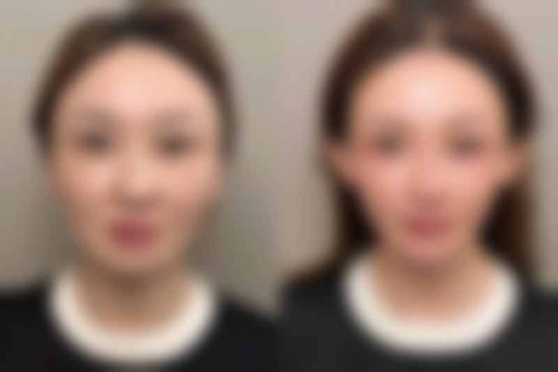 雅美整形好吗