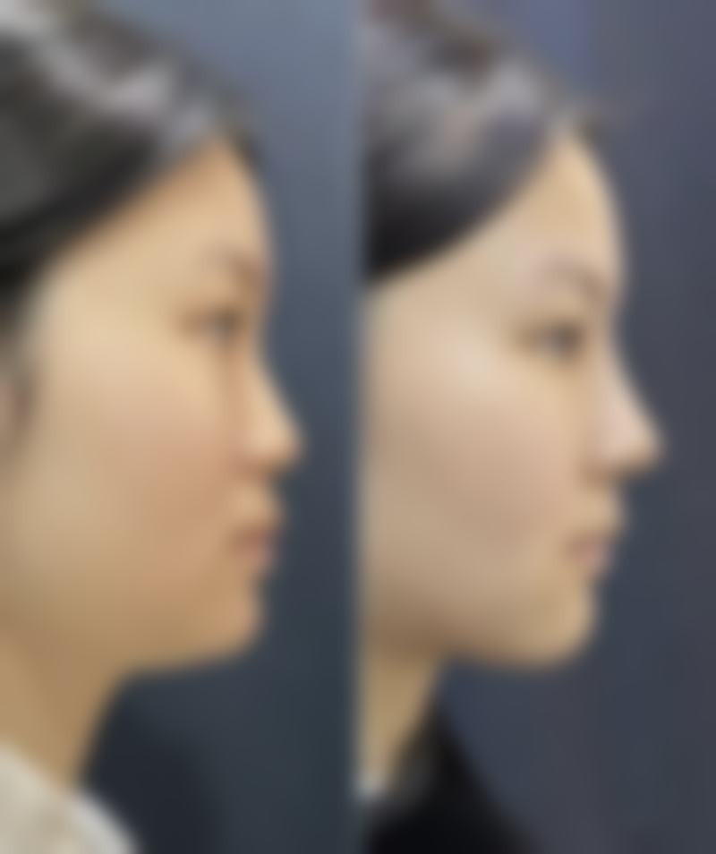 【韩国遇见美整形医院皮肤科特色项目:】