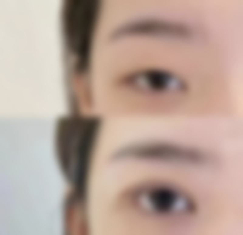 【韩国遇见美整形医院皮肤科是正规的吗?】