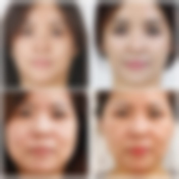 【韩国ARTLINE皮肤科整形医院核心优势:】