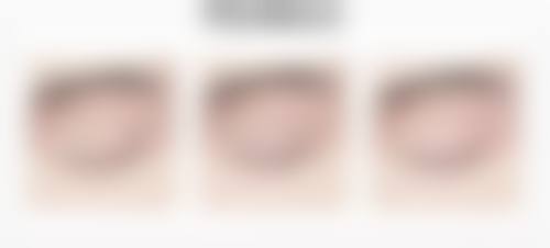 【张敏珠医生口碑怎么样？】