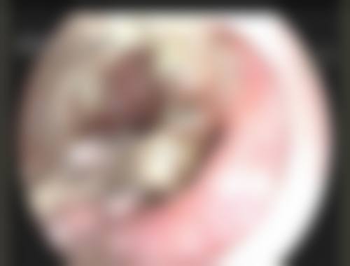 【临沧赫伦美整形医院地址:】