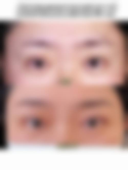 【张敏珠医生技术特点：】