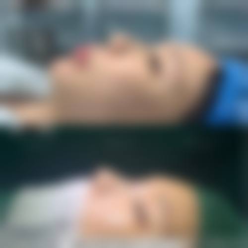 该医院的特色项目可不少。主要提供眼周祛痘美容服务,像祛眼袋、除皱纹、面部提升等。此外,还有去副乳、玻尿酸丰苹果肌、全切双眼皮、手臂吸脂等项目。这些项目涵盖了面部和身体多个部位的美容需求,能满足不同顾客的变得更美愿望。