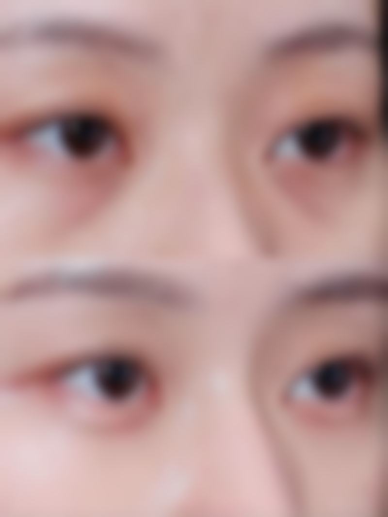 虽然目前没有具体的医生名字信息,但可以知道的是,医院有经验多的团队。他们凭借着丰富的诊疗经验和专精的整疗技术,为顾客提供美容解决方案。相信在他们的操作下,顾客能收获满意的美容成效。