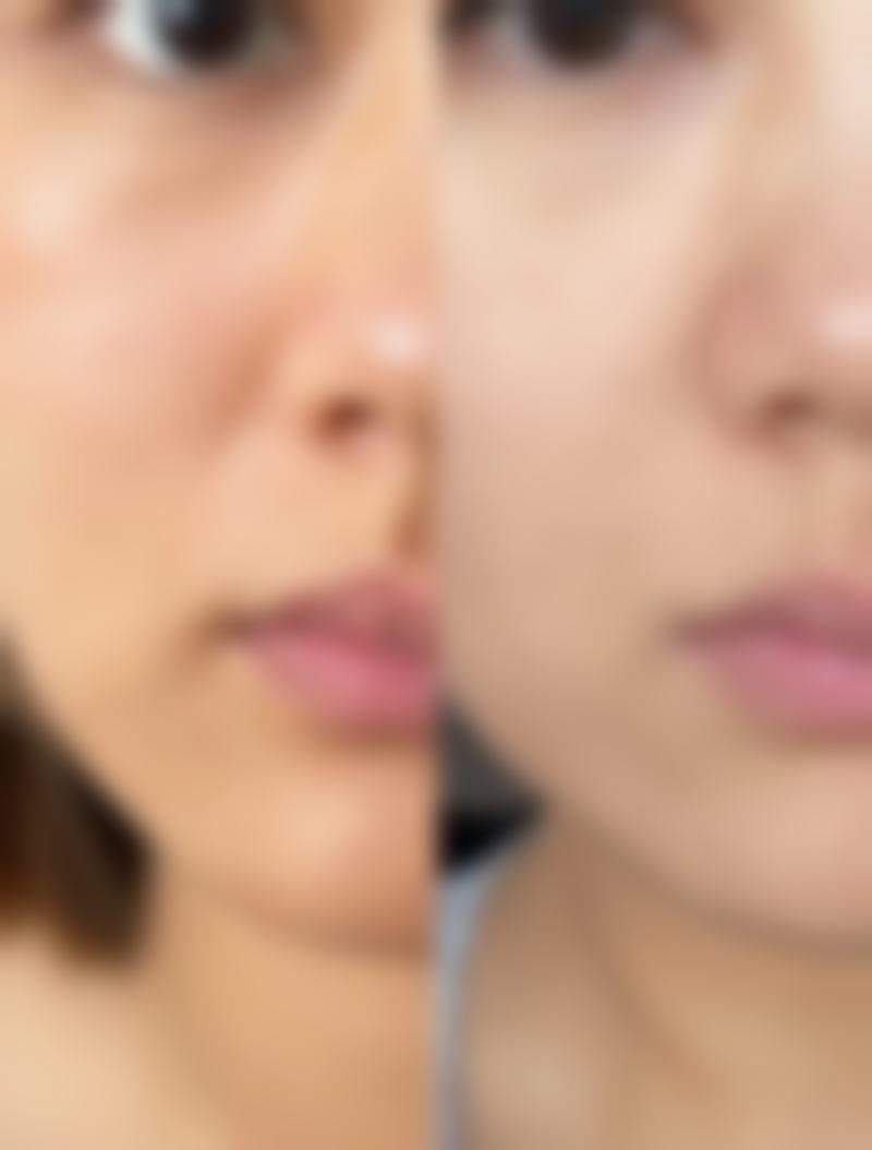 【阳泉迪美医疗美容诊所核心优势:】