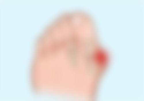 美白针和水光针的区别
