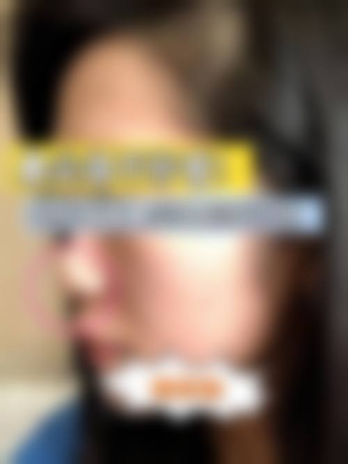 【傅崇华医生技术特点】