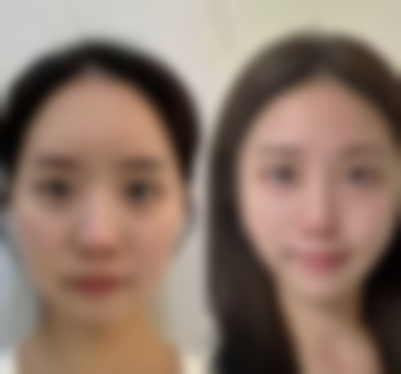【延吉赵美花保健医学美容医院特色项目:】