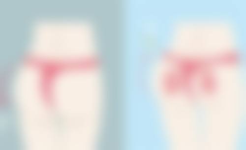 瘦脸针与其他瘦脸方法的比较