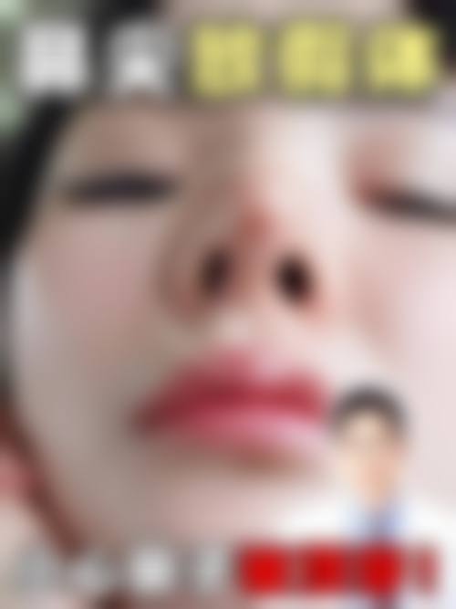 【尹盛浩医生擅长项目】