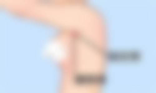 【渋谷FEMMY诊所特色项目：】