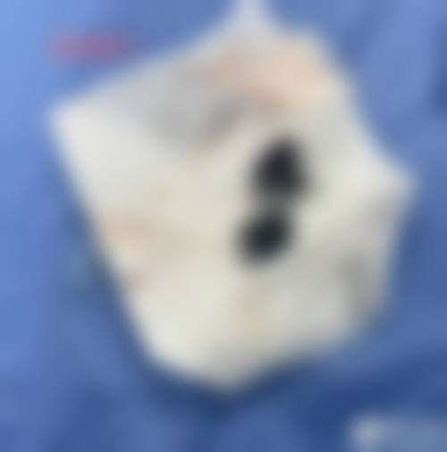【  合意言得整形外科医生名单：】