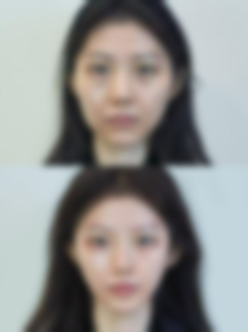 【金峴進医生怎么预约挂号?】