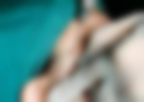 打了瘦脸针2个小时后平躺了