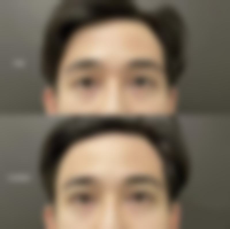 西昌平安整形医院专注于特色专科建设,打造出了多种独具优势的特色医疗服务项目。具体包括丰唇,通过专精的技术让嘴唇变得更加饱满诱人;兔唇修复,为有先天性唇裂问题的患者带来希望;纹唇,能让嘴唇拥有持久美丽的色泽;厚唇改薄,帮助那些觉得自己嘴唇过厚的人改善唇部形态;小口改大,让嘴型更加协调美观。
