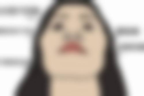 瘦脸针一般打50单位还是100单位