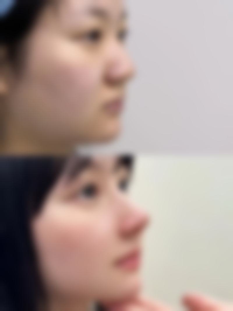 【徐州云龙有美医疗美容诊所患者口碑评价:】