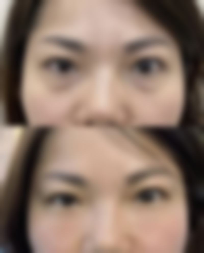【平凉承美医疗美容诊所参考价格表:】