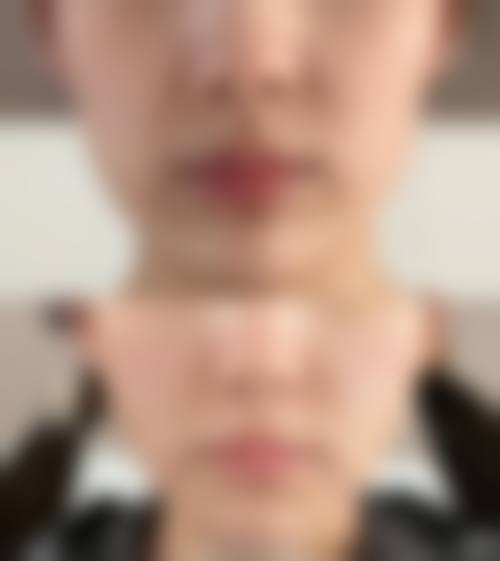 【付洪斌医生怎么预约挂号?】