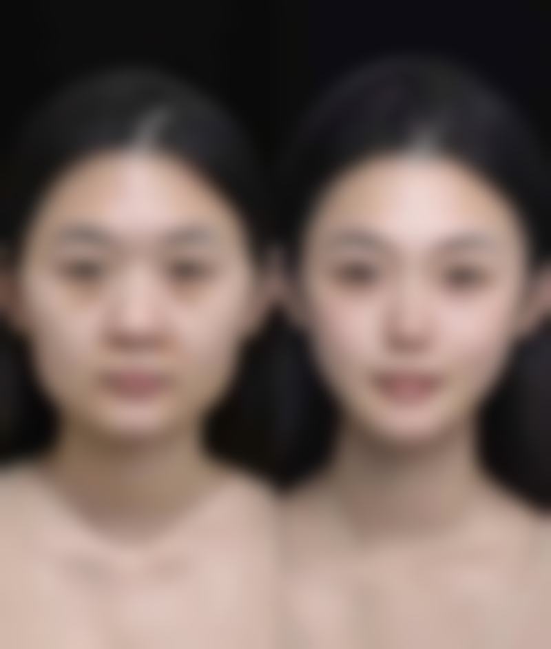 武汉斯启诺医美仪器抗衰价格880元起,医院开展该项目的优势