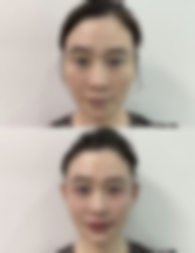 【临沂玉婕医院整形美容中 心特色项目:】