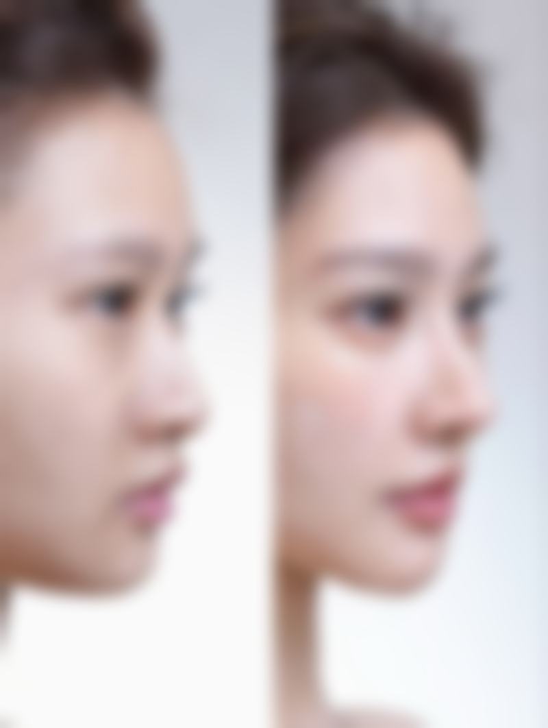 【衡水瑞美医疗美容门诊部是正规的吗?】