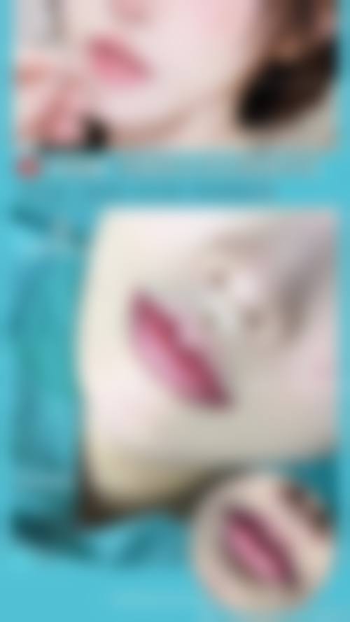 【西安新城东方美医疗美容诊所怎么预约挂号?】