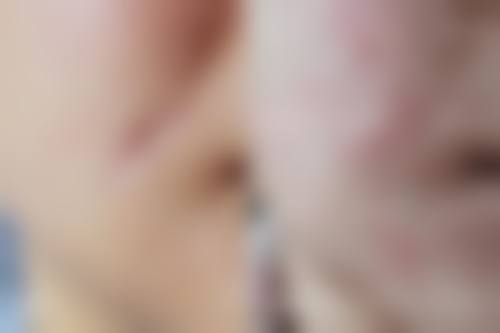 求美者可通过电话或法定网站进行预约,详细信息可在医院官网查询。这种多样化的预约方式,方便了不同需求的求美者,无论你是喜欢打电话沟通,还是习惯在网上操作,都能轻松完成预约,开启自己的变得更美之旅。
