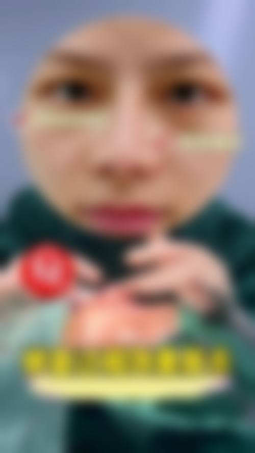 【崔任惇医生技术特点】