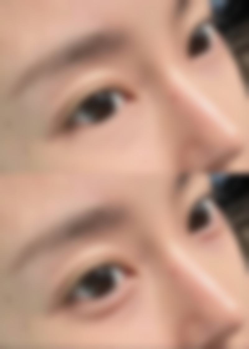 【成都蓉雅晶肤医疗美容部是正规的吗?】