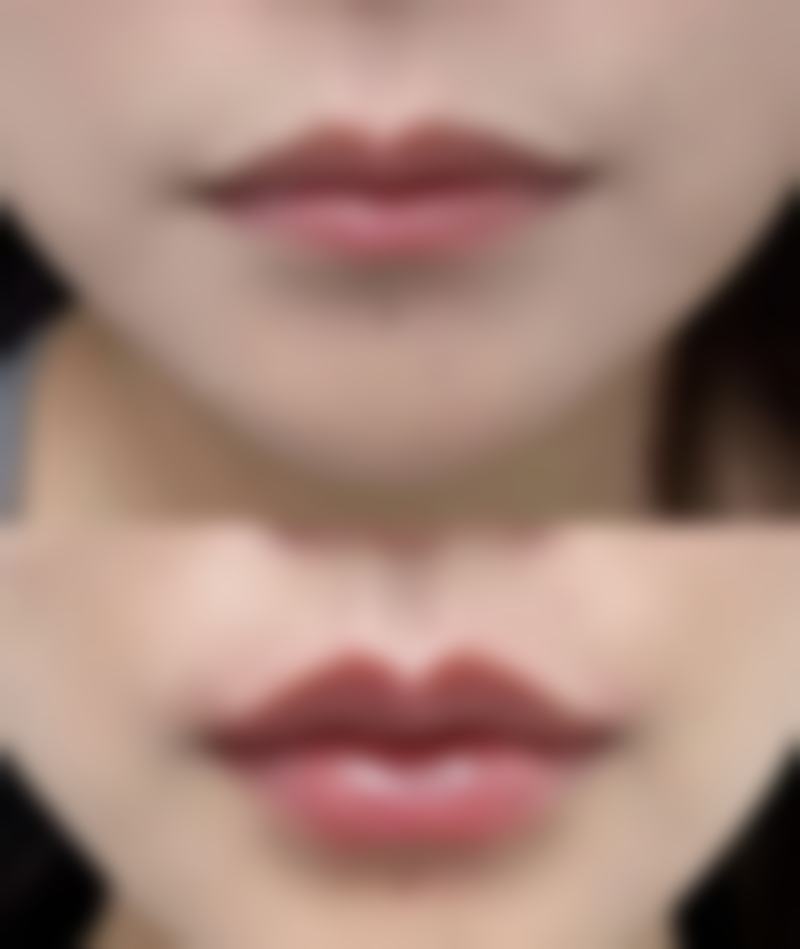 【杨瑞黎医生口碑怎么样？】