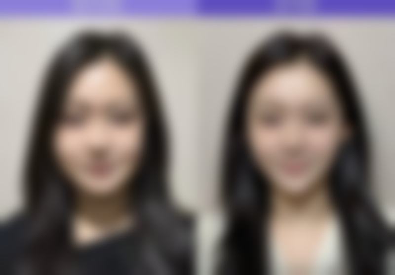 【罗滨林医生擅长项目:】