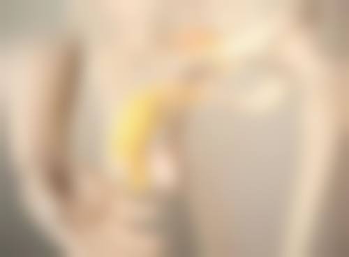 脸上有黄褐斑可以打水光针吗