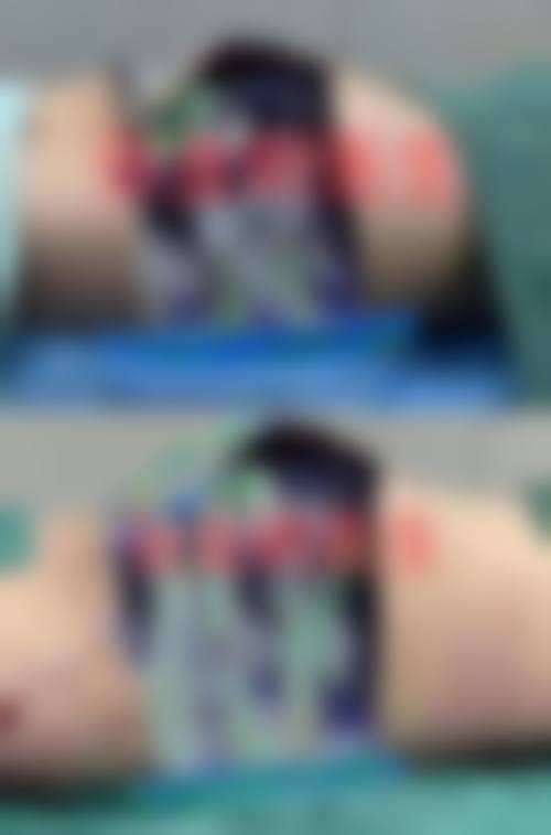 【岩峰医生口碑怎么样？】