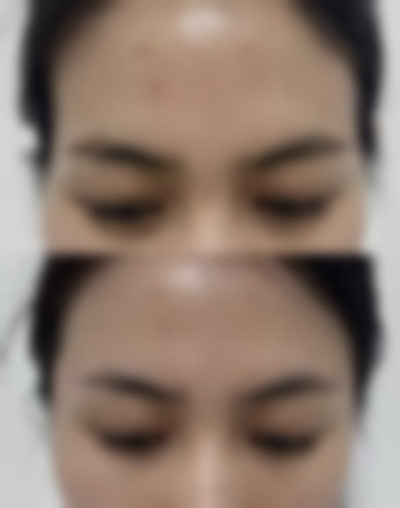 【Jenny Clinic 大宫参考价格表:】