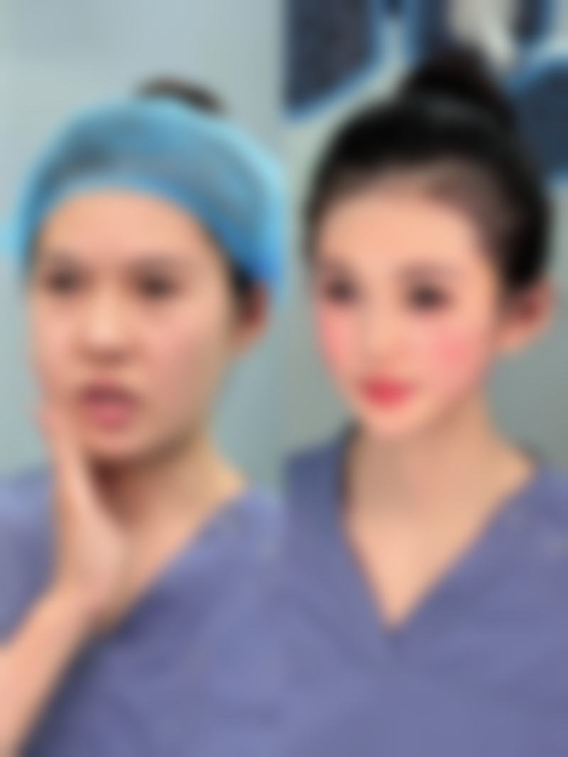 打完瘦脸针十天后仍无变化是怎么回事