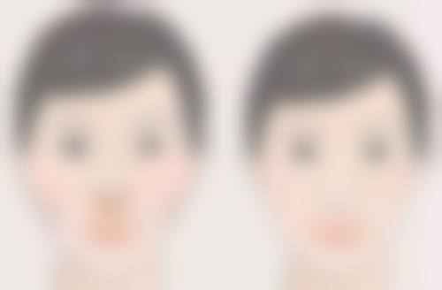 除皱可以维持多久?