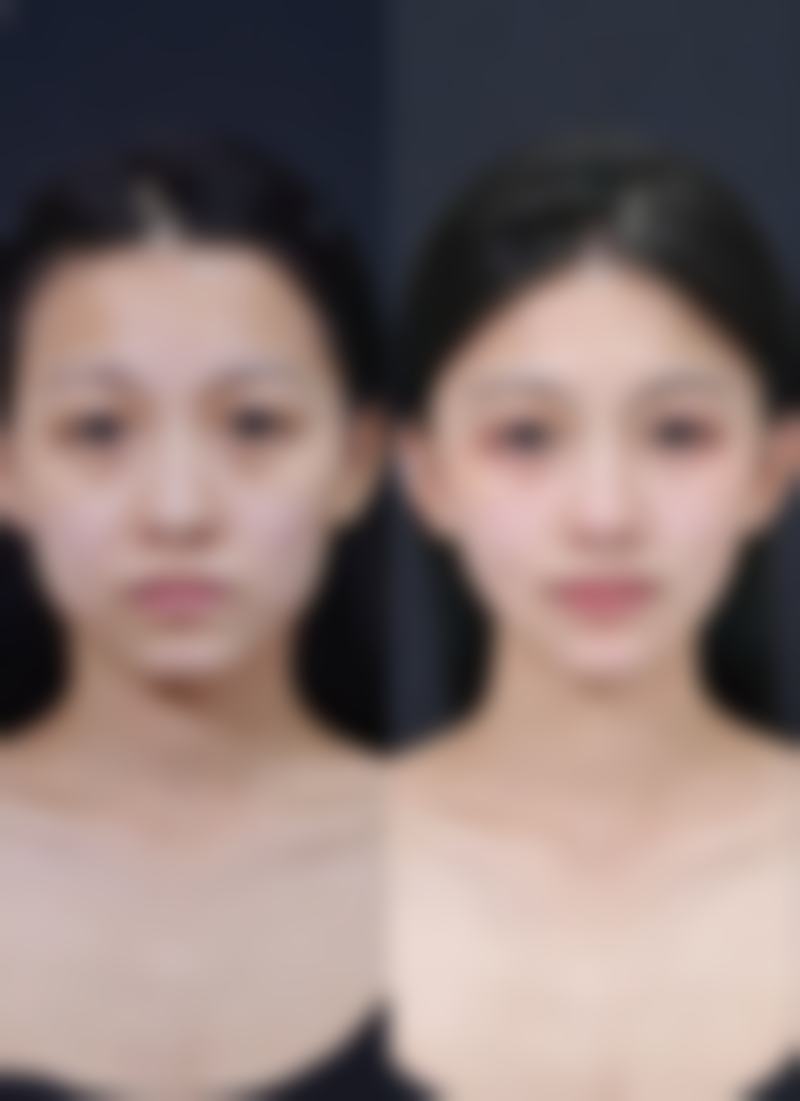 种植头发真的可以自然生长吗