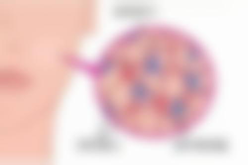 如何选择合适的医院和医生