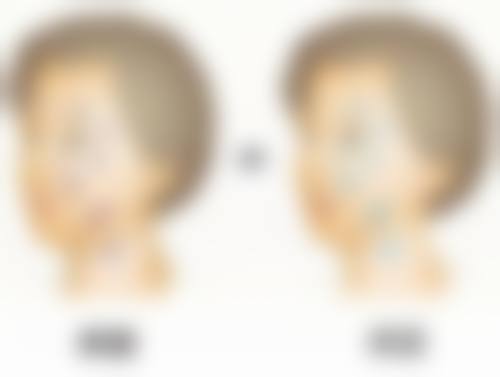 瘦脸针哪里打比较正规