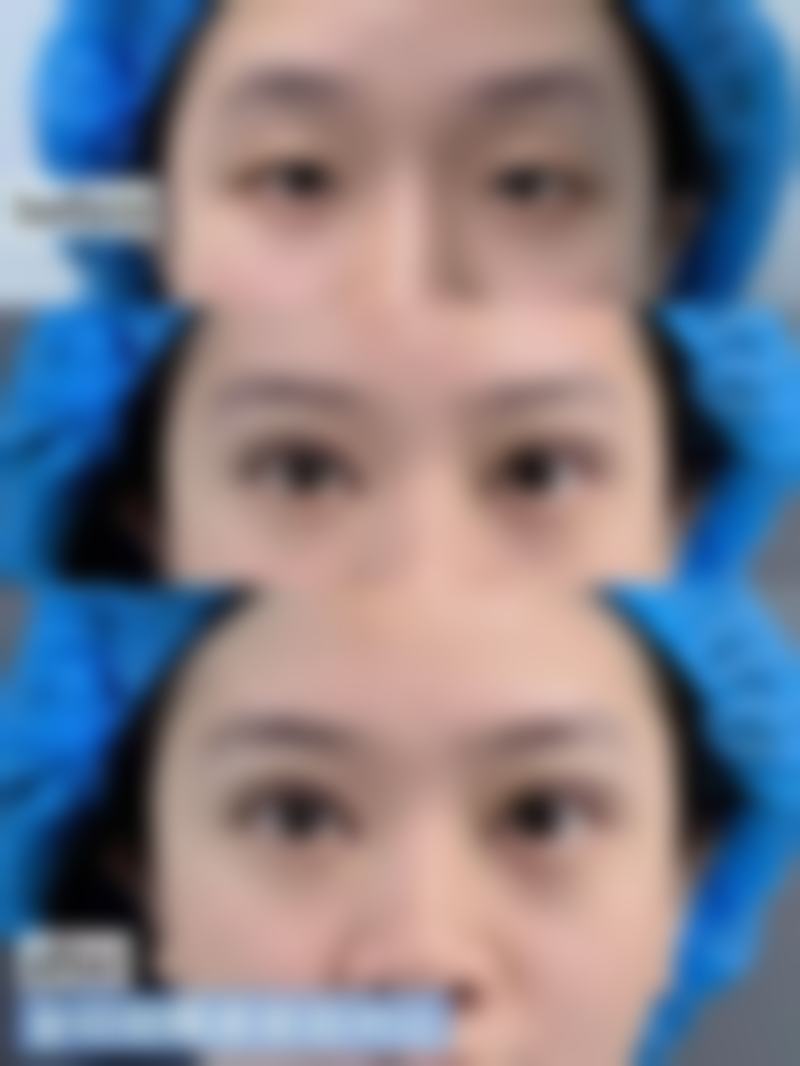 虽然目前资料中未提及具体的医生名字,但可以知道诊所拥有专精的医疗团队。他们都具备丰富的临床经验和专精知识,能够根据每位顾客的不同情况,制定出更适合的美容方案,为顾客提供优质的服务。