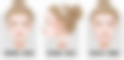 打瘦脸针会垮脸吗