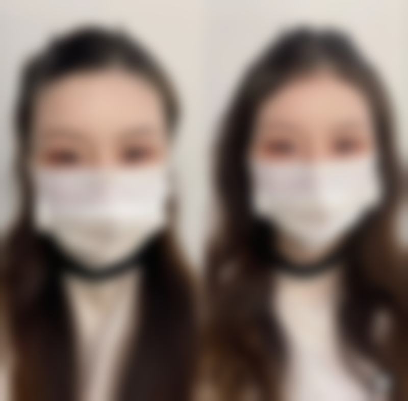 丰太阳穴有副作用吗