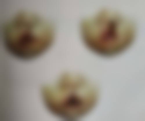 嘴呼吸导致的嘴凸该怎么办