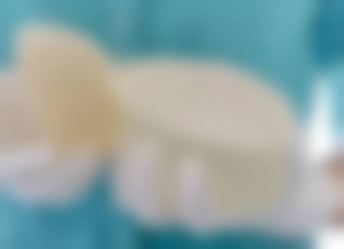 厚唇改薄手术介绍