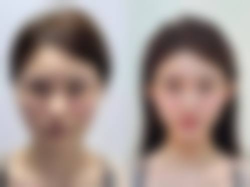 【荆门市第一人民医院整形美容中 心是正规的吗?】