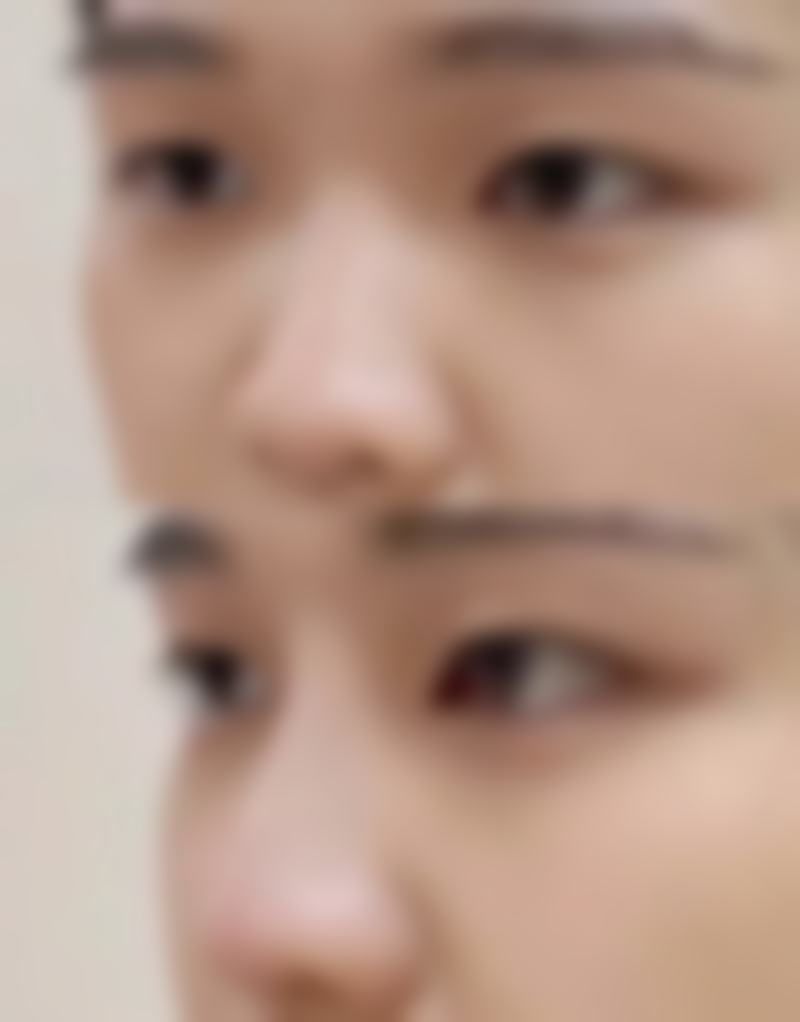 【重庆优思悦美医疗美容诊所怎么预约挂号?】